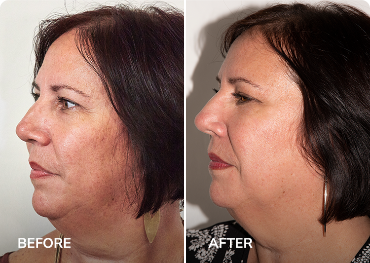 Rebecca Results